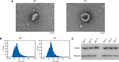 Serum exosomal circCCDC66 as a potential diagnostic and prognostic biomarker for pituitary adenomas